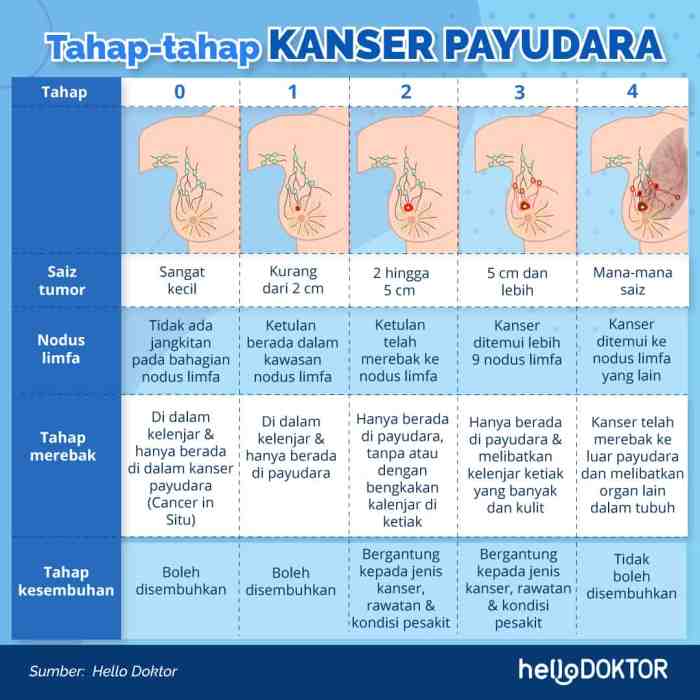 kenapa balik kiri tidak ada