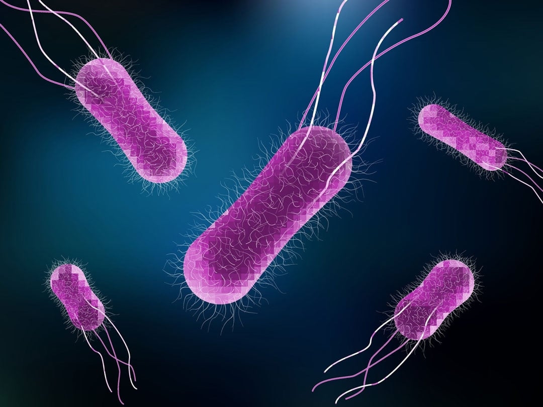 salmonella typhi h 1 320 artinya terbaru