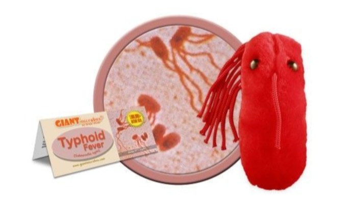 salmonella typhi o positif 1 160 artinya