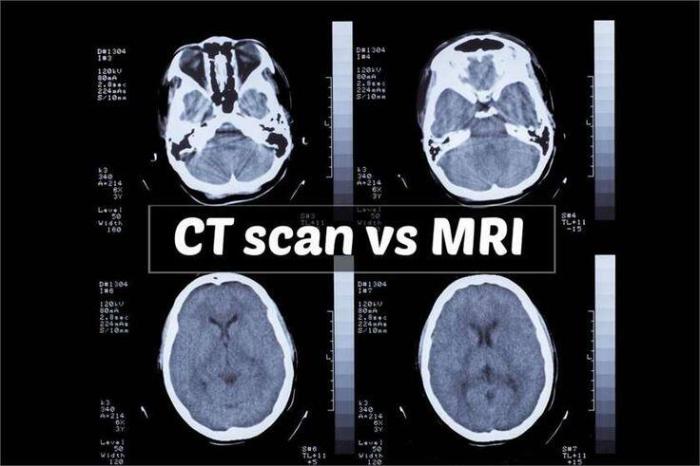 perbedaan scan dan fotocopy