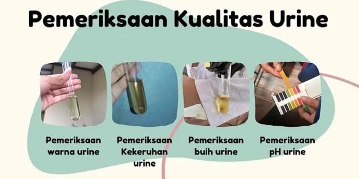 zat boleh urine sebutkan terdapat jawaban