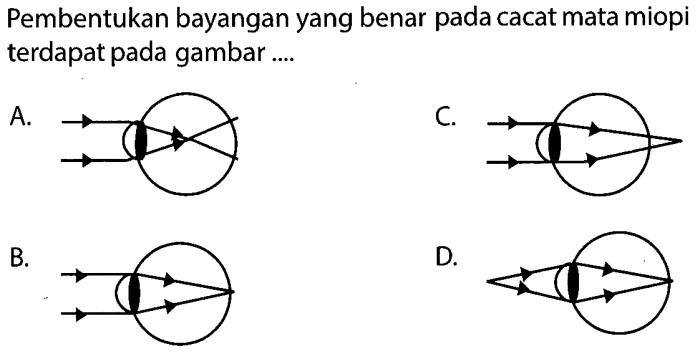 pembentukan bayangan pada mata