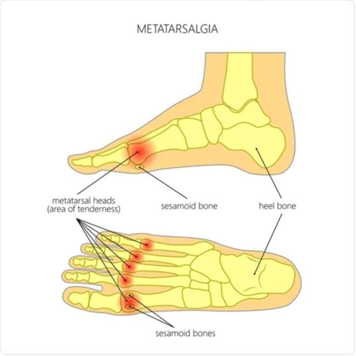 bahasa arabnya telapak kaki terbaru