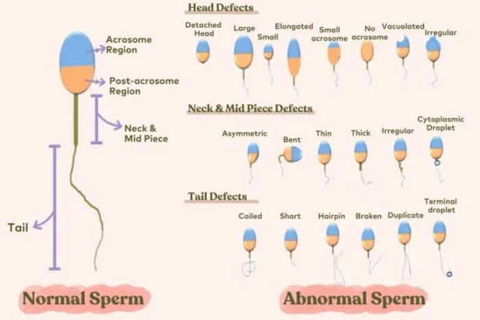 bentuk kepala normocephal adalah