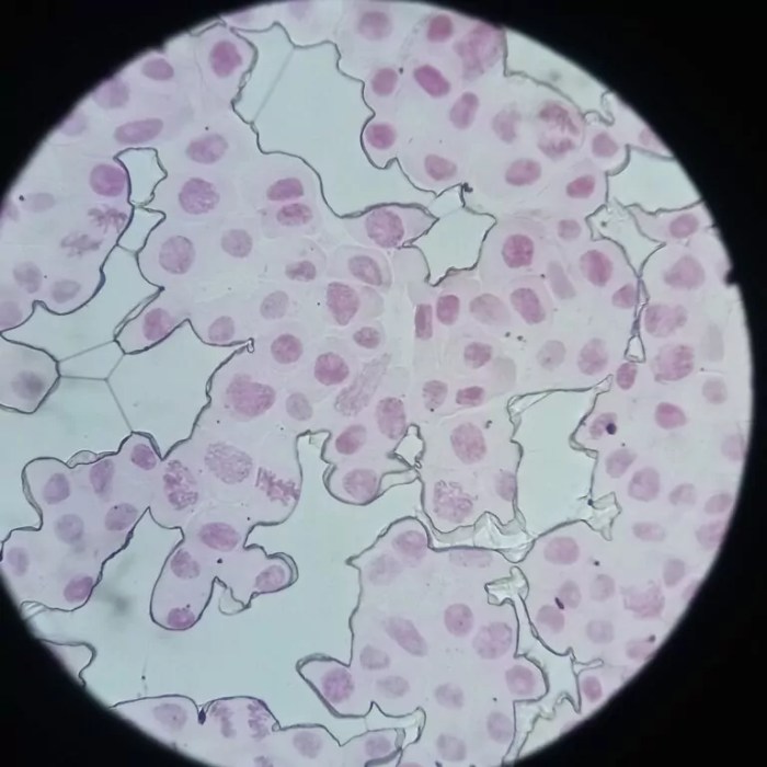 mitosis pembelahan bawang akar merah laporan praktikum