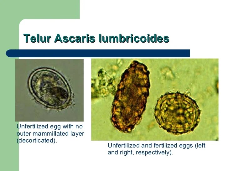 Ciri ciri telur cacing ascaris lumbricoides