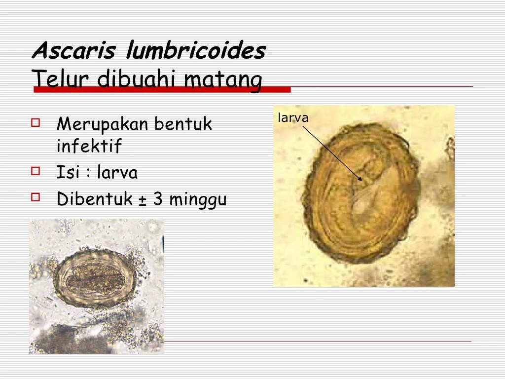 Ciri ciri telur cacing ascaris lumbricoides