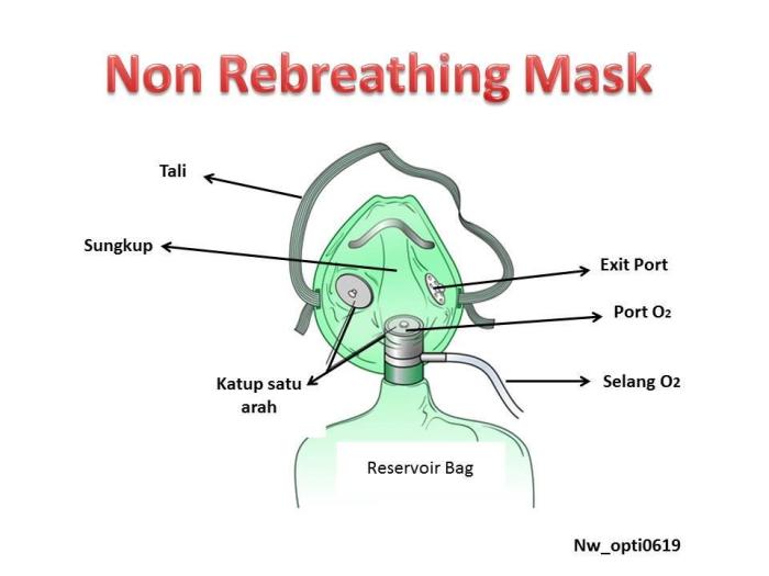 non rebreathing mask adalah terbaru