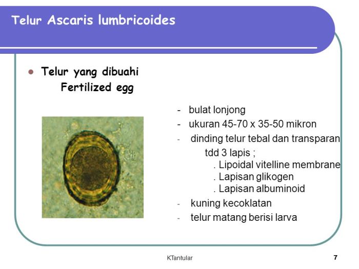 Ascaris lumbricoides telur cacing gelang macam infertile parasit intestinal roundworm parasitology practical laboratory junglekey cram flashcards zoology hseb unfertilized fertilized