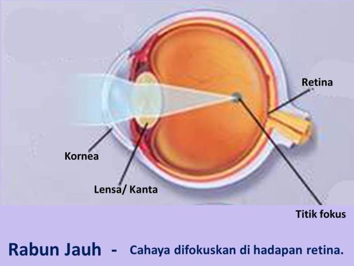 fotocopy hasil inilah merata penyebab tidak