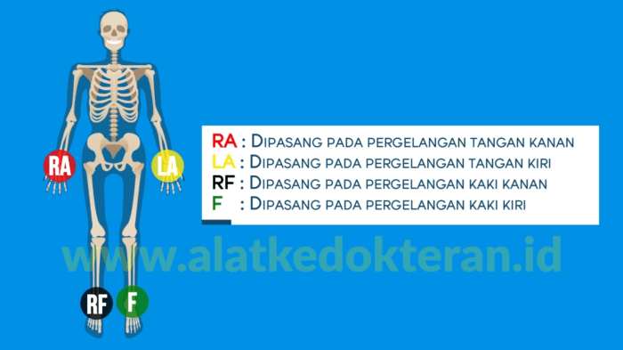 Jelaskan kegunaan dari fluksi pada elektroda