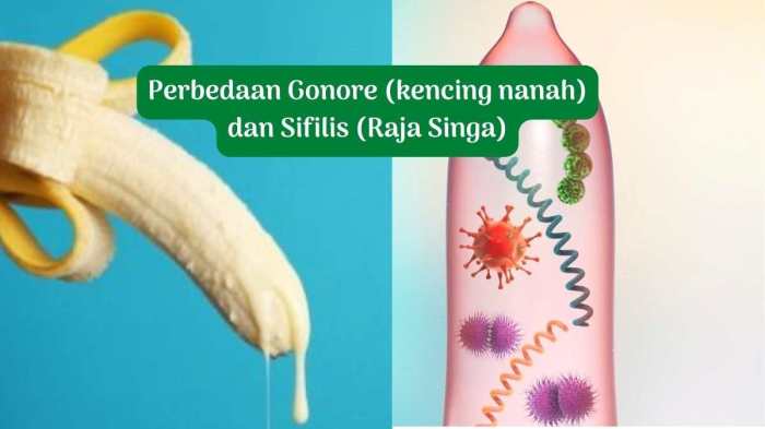 perbedaan sifilis dan gonore terbaru