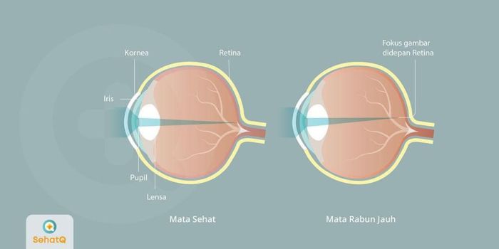 fotocopy jarak jauh disebut juga dengan