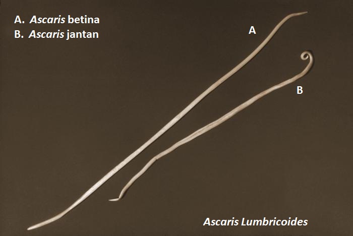 Ascaris lumbricoides ascariasis telur cdc infertil cacing unfertilized gelang parasitic 200x dpdx sumber